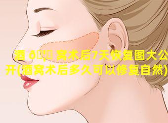 酒 🦊 窝术后7天恢复图大公开(酒窝术后多久可以修复自然)